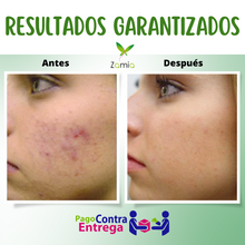 Load image into Gallery viewer, CREMA ANTIACNÉ