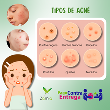 Load image into Gallery viewer, CREMA ANTIACNÉ